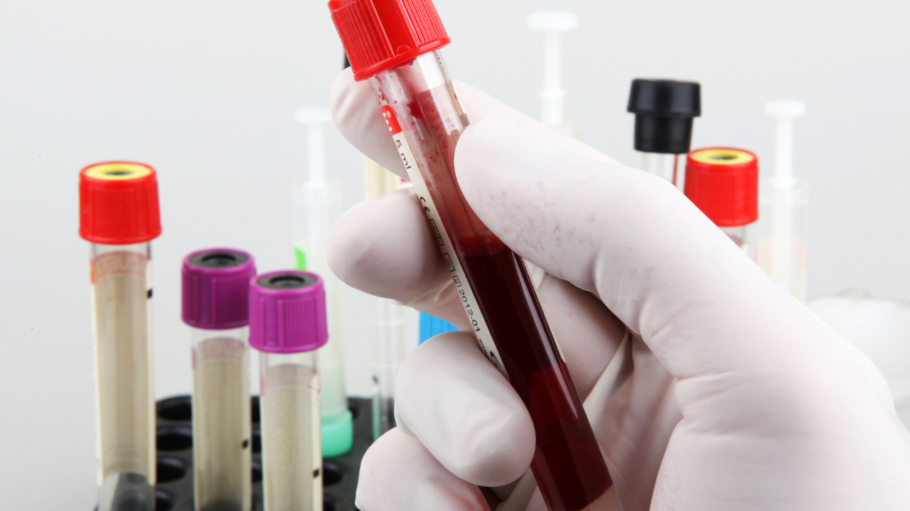 From Rural Camps to City Labs: Making Diagnostics Truly Accessible